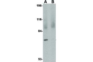 Image no. 2 for anti-Junctophilin 4 (JPH4) (C-Term) antibody (ABIN6656241)