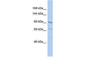 Image no. 1 for anti-Ral Guanine Nucleotide Dissociation Stimulator (RALGDS) (N-Term) antibody (ABIN2786615)