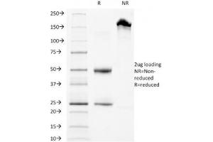 Image no. 1 for anti-Lysosomal-Associated Membrane Protein 3 (LAMP3) antibody (ABIN3023872)