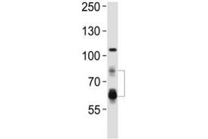 Image no. 9 for anti-Proprotein Convertase Subtilisin/kexin Type 9 (PCSK9) (AA 144-173) antibody (ABIN3032339)