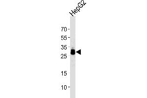 Image no. 2 for anti-Palmitoyl-Protein Thioesterase 1 (PPT1) antibody (ABIN4913200)