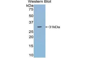 Image no. 1 for anti-TNFRSF1A-Associated Via Death Domain (TRADD) (AA 21-259) antibody (ABIN1860857)