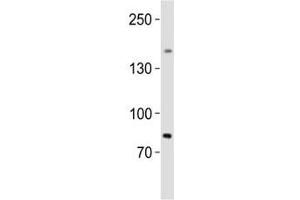 Image no. 1 for anti-Sal-Like 4 (SALL4) (AA 1035-1069) antibody (ABIN3028997)