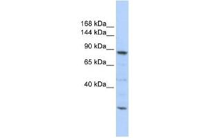 Image no. 1 for anti-CDC5 Cell Division Cycle 5-Like (S. Pombe) (CDC5L) antibody (ABIN633497)