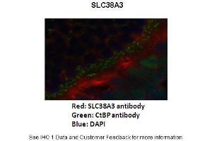 Image no. 3 for anti-Solute Carrier Family 38 Member 3 (SLC38A3) (N-Term) antibody (ABIN2775351)