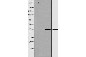 anti-Heterogeneous Nuclear Ribonucleoprotein A2/B1 (HNRNPA2B1) (N-Term) antibody