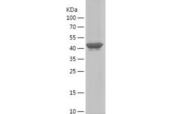 MYH1 Protein (AA 449-651) (IF2DI tag)