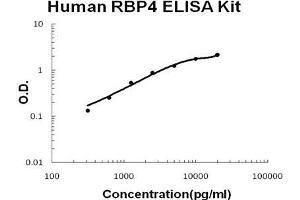 Image no. 1 for Retinol Binding Protein 4, Plasma (RBP4) ELISA Kit (ABIN921107)
