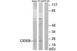 Image no. 2 for anti-Cell Death-Inducing DFFA-Like Effector B (CIDEB) (AA 91-140) antibody (ABIN1534431)