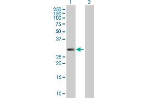 Western Blot analysis of SPINT2 expression in transfected 293T cell line by SPINT2 MaxPab polyclonal antibody.