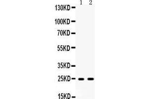 Image no. 3 for anti-Apolipoprotein A-I (APOA1) (AA 25-259) antibody (ABIN3044502)