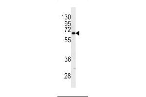 Image no. 1 for anti-Keratin 9 (KRT9) (AA 429-456) antibody (ABIN5533217)