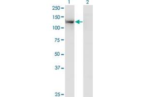 Western Blot analysis of TSHZ1 expression in transfected 293T cell line by SDCCAG33 monoclonal antibody (M07), clone 2F1.