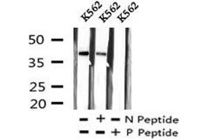 Image no. 5 for anti-Jun D Proto-Oncogene (JUND) (pSer259) antibody (ABIN6269901)