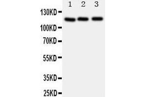Image no. 1 for anti-Myosin Phosphatase, Target Subunit 1 (PPP1R12A) (AA 1-17), (N-Term) antibody (ABIN3043106)