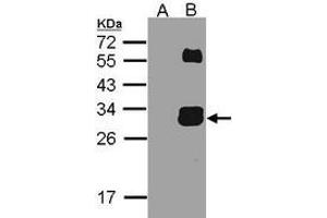 Image no. 2 for anti-Kallikrein 7 (KLK7) (AA 1-237), (N-Term) antibody (ABIN488082)