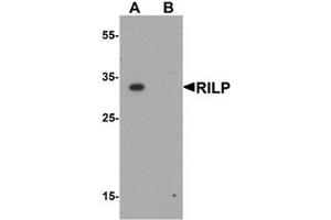Image no. 2 for anti-Rab Interacting Lysosomal Protein (RILP) (Middle Region) antibody (ABIN1450144)