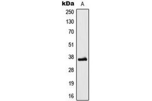 Image no. 1 for anti-Low Density Lipoprotein Receptor Class A Domain Containing 3 (LDLRAD3) (Center) antibody (ABIN2706469)