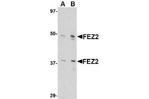 Image no. 1 for anti-Fasciculation and Elongation Protein zeta 2 (Zygin II) (FEZ2) (Center) antibody (ABIN499834)