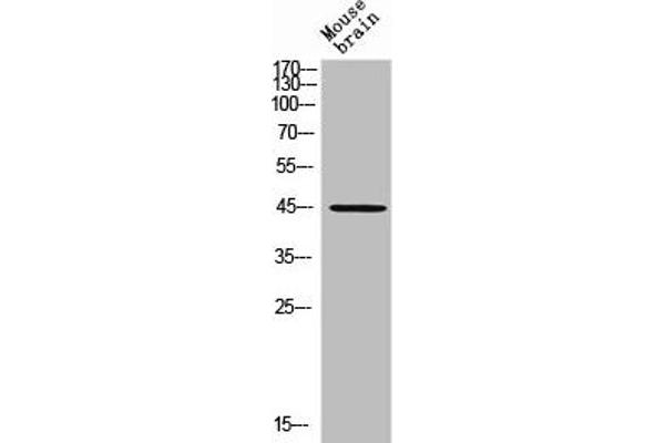 RHD Antibodies