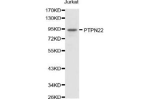 Western blot analysis of extracts of Jurkat cell lines, using PTPN22 antibody.