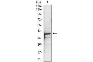 Image no. 2 for anti-PDZ Binding Kinase (PBK) antibody (ABIN969345)