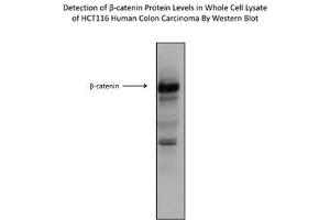 Image no. 6 for anti-Catenin (Cadherin-Associated Protein), beta 1, 88kDa (CTNNB1) (C-Term) antibody (ABIN2792527)