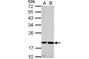 WB Image Sample (30 ug of whole cell lysate) A: A549 B: MCF-7 12% SDS PAGE antibody diluted at 1:1000