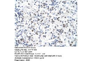 Image no. 1 for anti-Ferrochelatase (FECH) (N-Term) antibody (ABIN2777033)