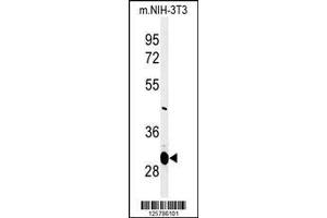 Image no. 1 for anti-Magnesium Transporter 1 (MAGT1) (AA 44-71), (N-Term) antibody (ABIN651247)