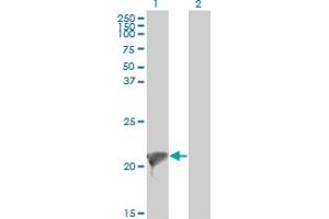 Western Blot analysis of TWIST2 expression in transfected 293T cell line by TWIST2 monoclonal antibody (M01), clone 3C8.