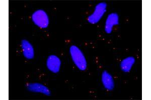 Image no. 1 for anti-Protein Inhibitor of Activated STAT, 2 (PIAS2) (AA 1-572) antibody (ABIN522503)