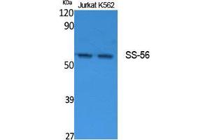 Image no. 1 for anti-Tripartite Motif Containing 68 (TRIM68) (Internal Region) antibody (ABIN3187642)