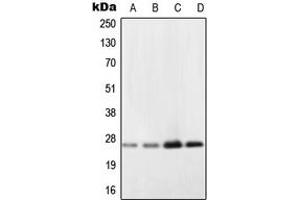 Image no. 1 for anti-NADH Dehydrogenase (Ubiquinone) Flavoprotein 2, 24kDa (NDUFV2) (Center) antibody (ABIN2706663)