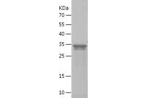 KISS1R Protein (AA 292-398) (IF2DI tag)