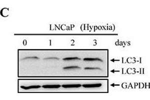 Image no. 112 for anti-Glyceraldehyde-3-Phosphate Dehydrogenase (GAPDH) (Center) antibody (ABIN2857072)