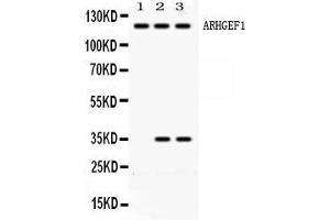 Image no. 3 for anti-rho Guanine Nucleotide Exchange Factor (GEF) 1 (ARHGEF1) (AA 41-71), (N-Term) antibody (ABIN4886475)