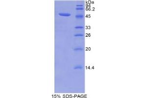 Image no. 1 for Lipocalin 12 (LCN12) protein (ABIN3010498)