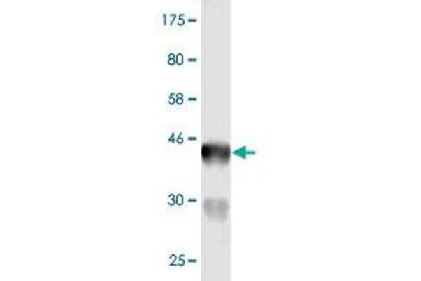 anti-B-Cell CLL/lymphoma 7C (BCL7C) (AA 86-164) antibody