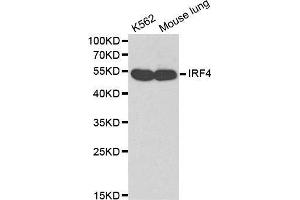 Image no. 1 for anti-Interferon Regulatory Factor 4 (IRF4) antibody (ABIN3021306)