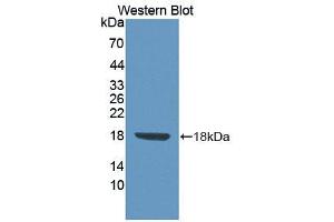 anti-Fibronectin Leucine Rich Transmembrane Protein 3 (FLRT3) (AA 29-152) antibody