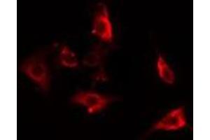 ABIN6275863 staining HepG2 cells by IF/ICC.