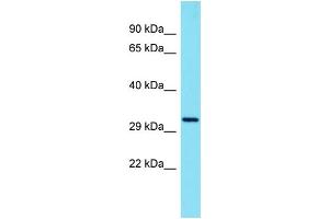 Image no. 1 for anti-TSR3 20S rRNA Accumulation (TSR3) (C-Term) antibody (ABIN2791283)