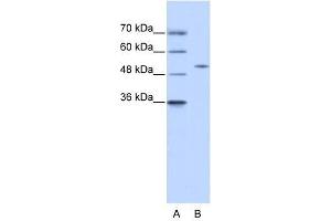 Image no. 1 for anti-Zinc Finger Protein 555 (ZNF555) (N-Term) antibody (ABIN927598)