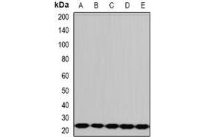 Image no. 2 for anti-Protein-L-Isoaspartate (D-Aspartate) O-Methyltransferase (PCMT1) (full length) antibody (ABIN6004682)