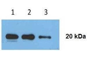 Image no. 3 for anti-CD81 (CD81) antibody (ABIN2862609)