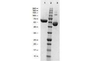 Image no. 1 for Albumin (ALB) protein (ABIN5624625)