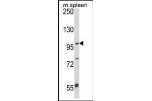 Image no. 1 for anti-Anoctamin 5 (ANO5) (AA 798-828), (C-Term) antibody (ABIN499159)
