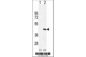 Image no. 1 for anti-Protein Kinase, AMP-Activated, gamma 1 Non-Catalytic Subunit (PRKAG1) (AA 1-30), (N-Term) antibody (ABIN655798)
