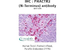 Image no. 1 for anti-Phosphatase and Actin Regulator 2 (PHACTR2) (N-Term) antibody (ABIN5693668)